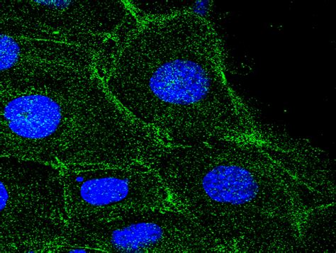 beta actin Polyclonal Antibody .